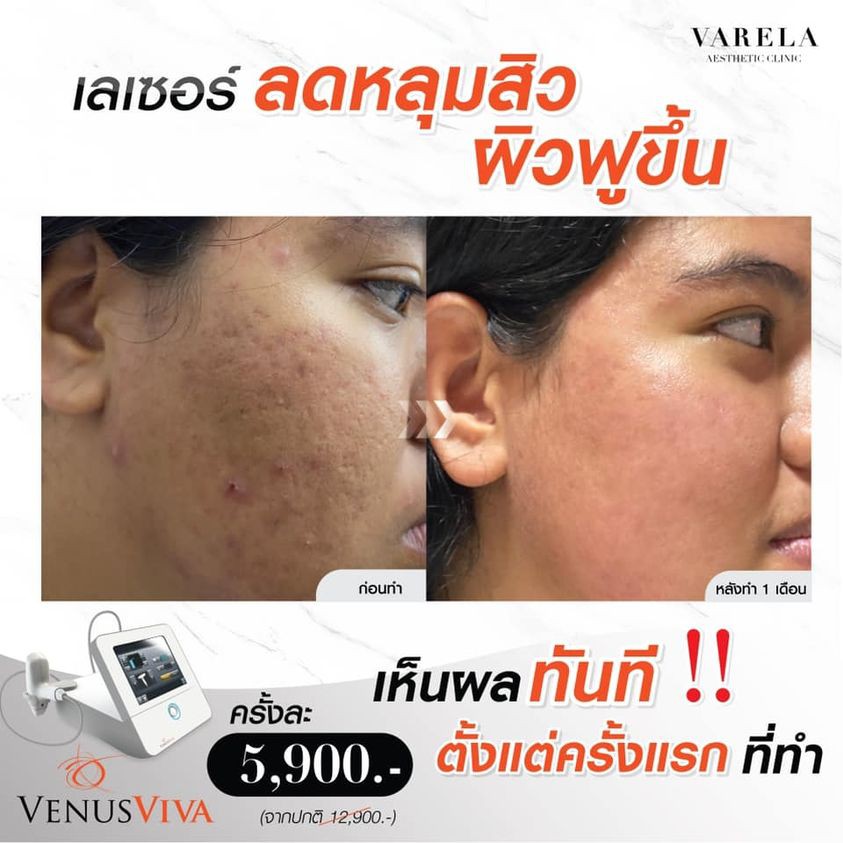 185147500_334955684628642_8580297978387648524_n