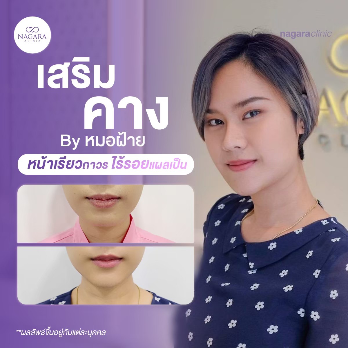 213610627_362869478539577_399035606904364021_n