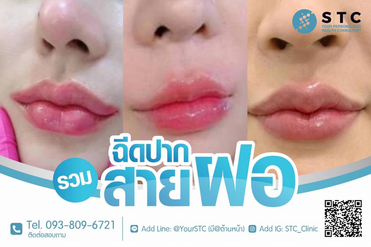 228221514_1555237261489805_9104457047282730514_n