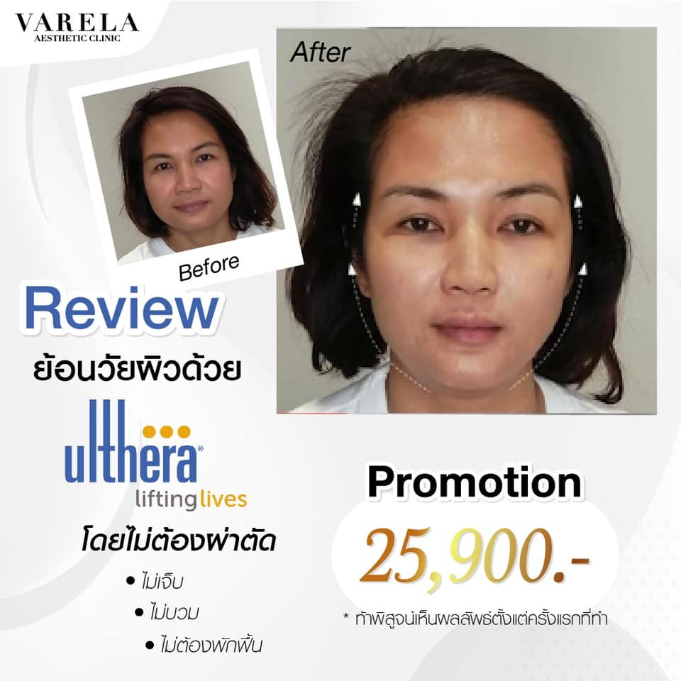 235588087_138392315142511_1622742672665815471_n