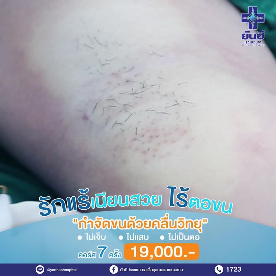 240840874_1214051745781538_8553441675639997479_n